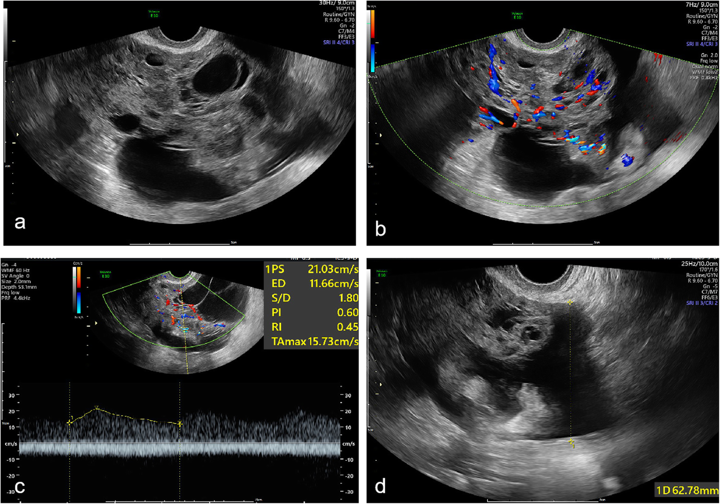 Fig. 5