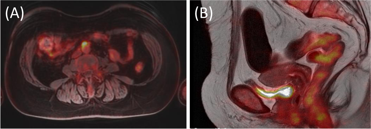 Fig. 4