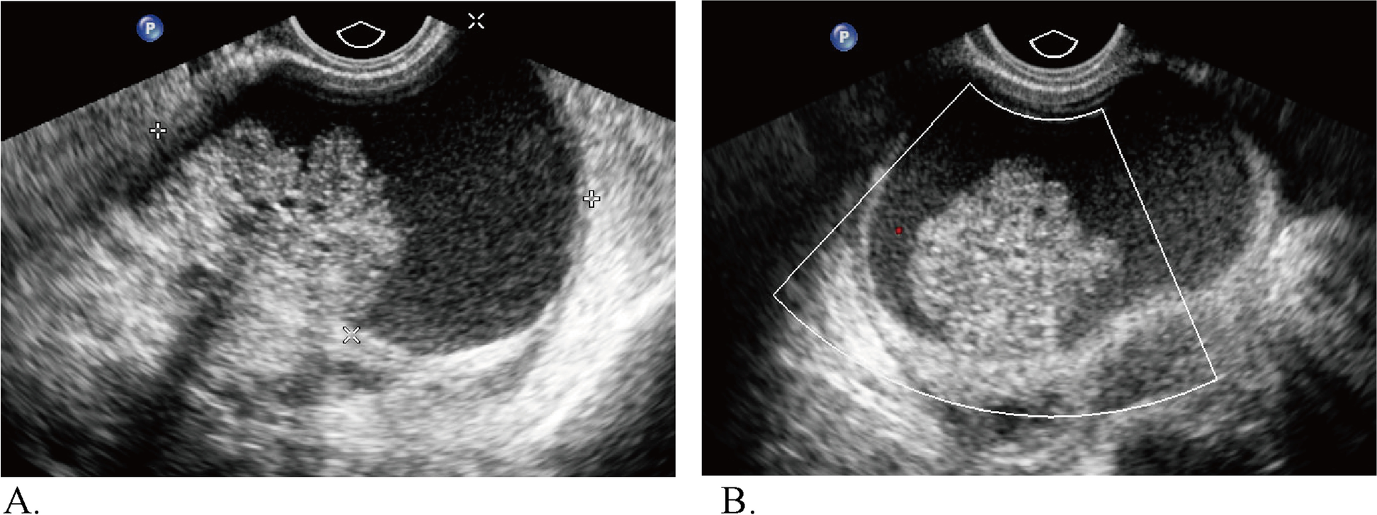 Fig. 5