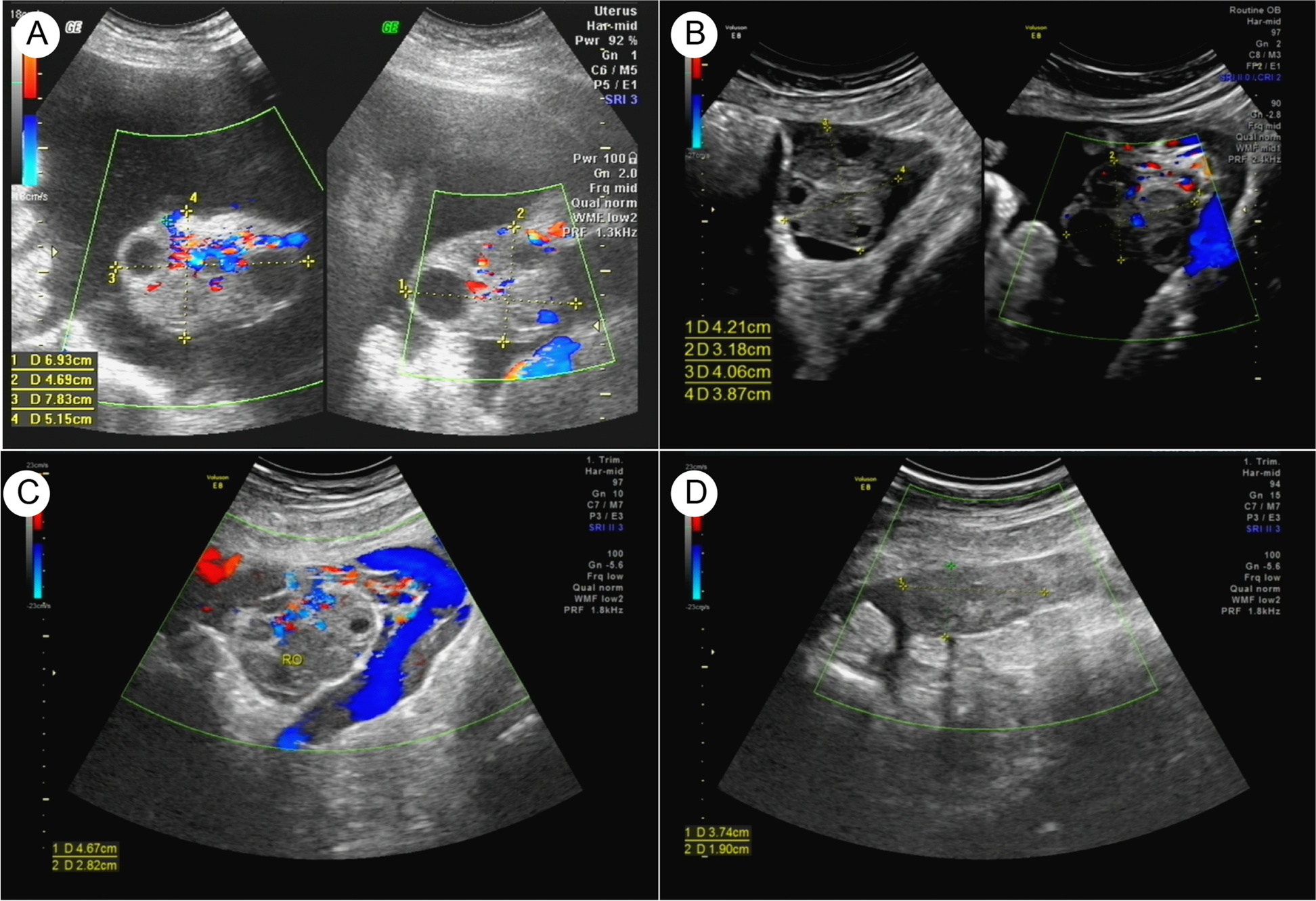 Fig. 1