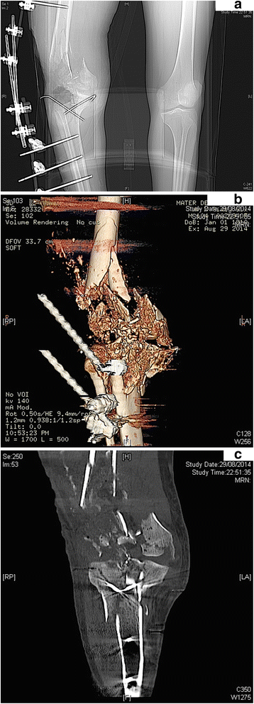 Fig. 4