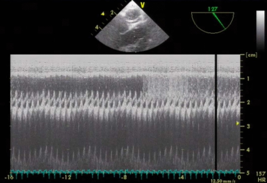 Fig. 2