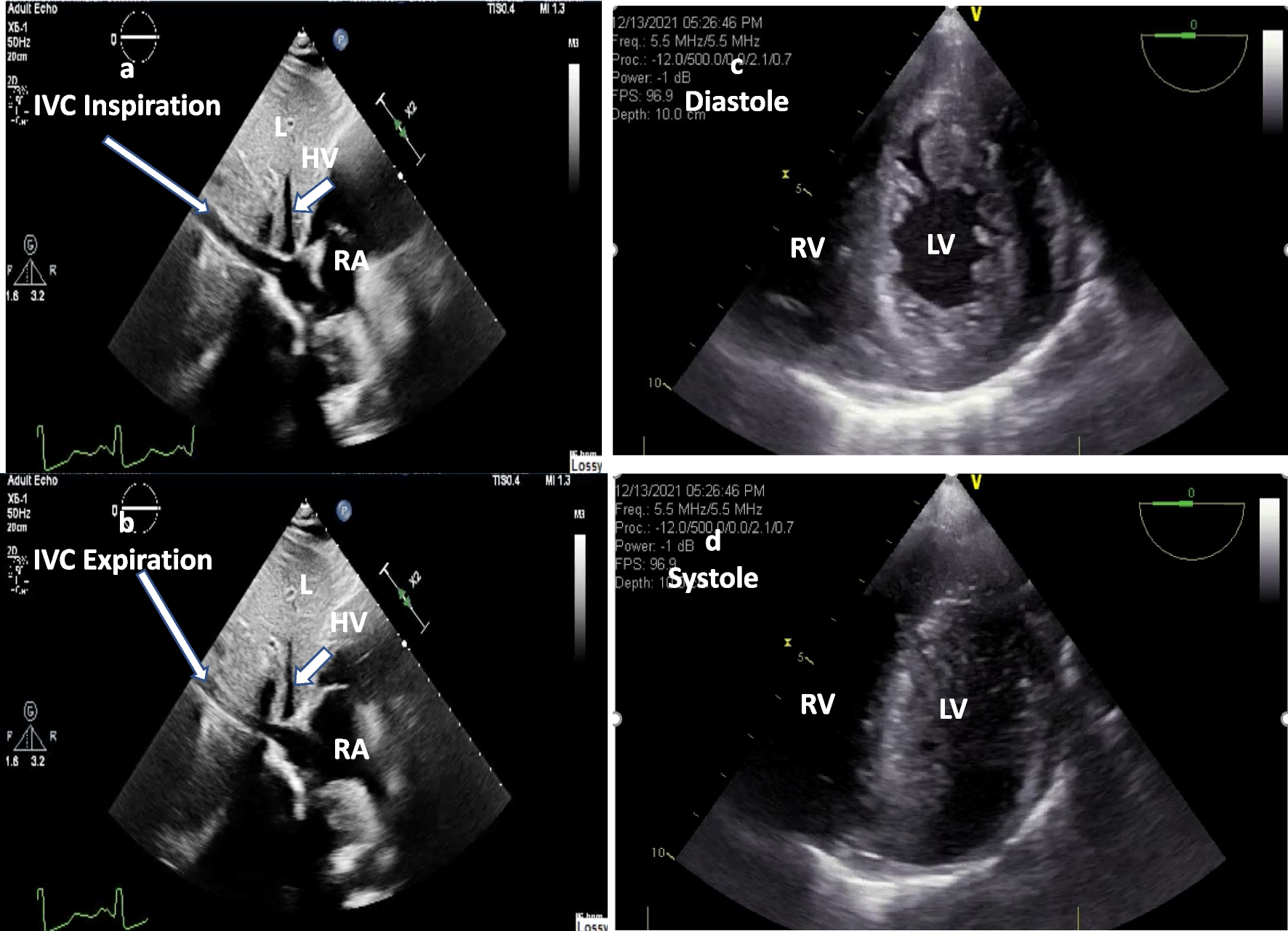 Fig. 4