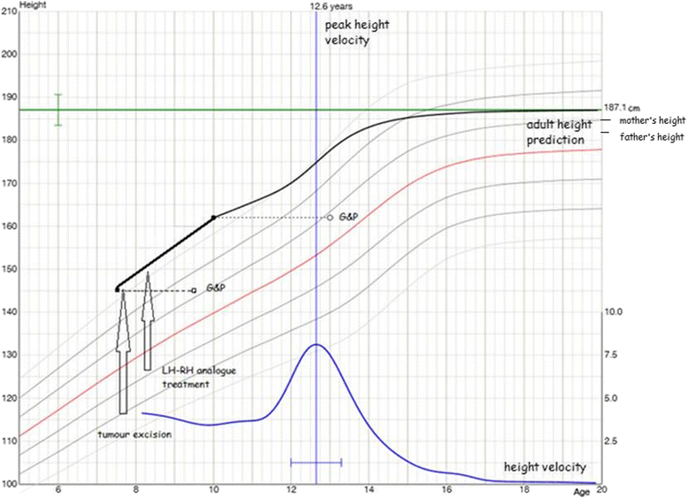 Bone Growth Chart