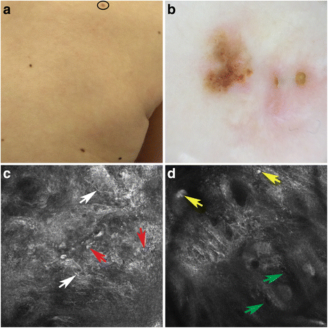 Fig. 3