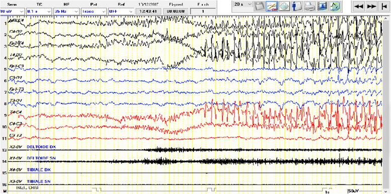 Fig. 1