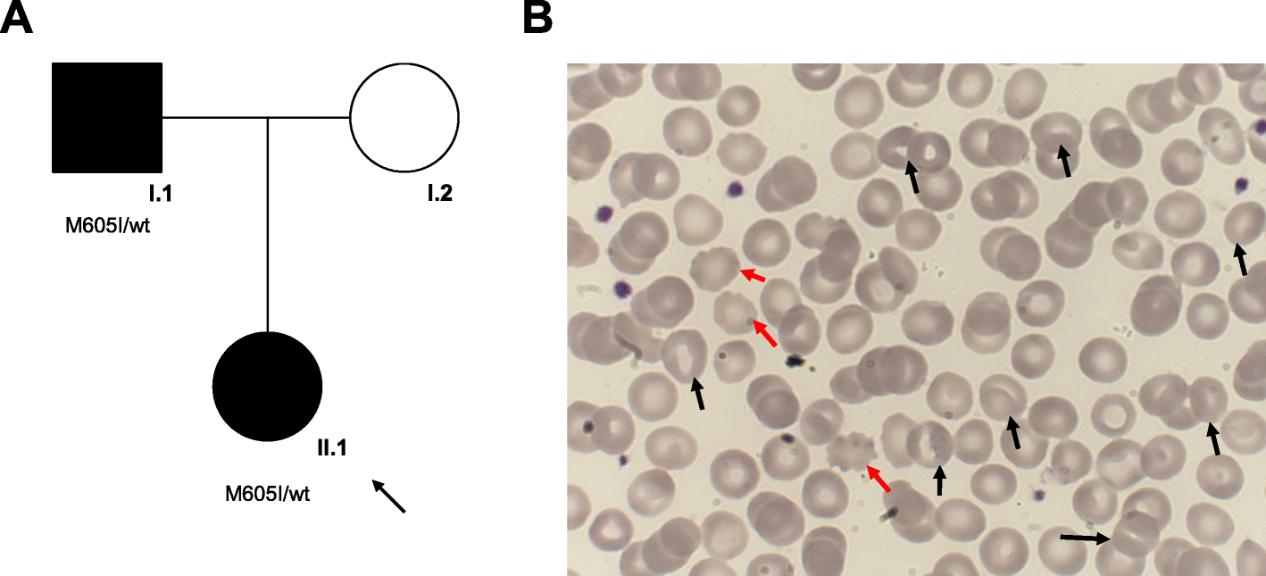 Fig. 1