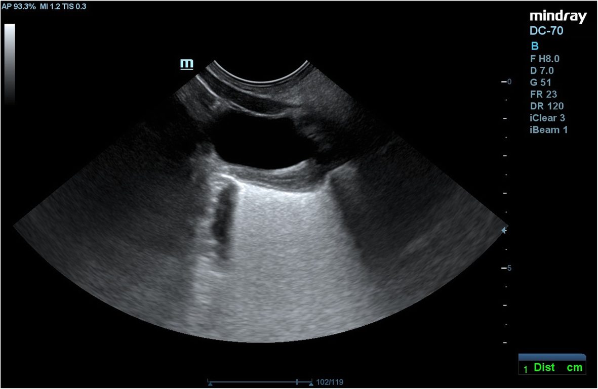 Fig. 7