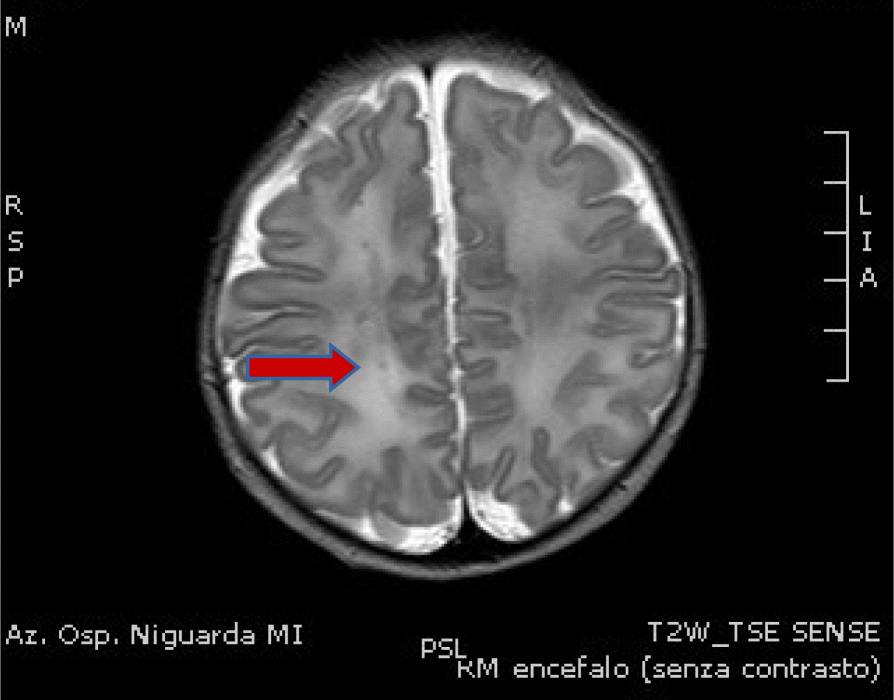 Fig. 1(abstract A19).