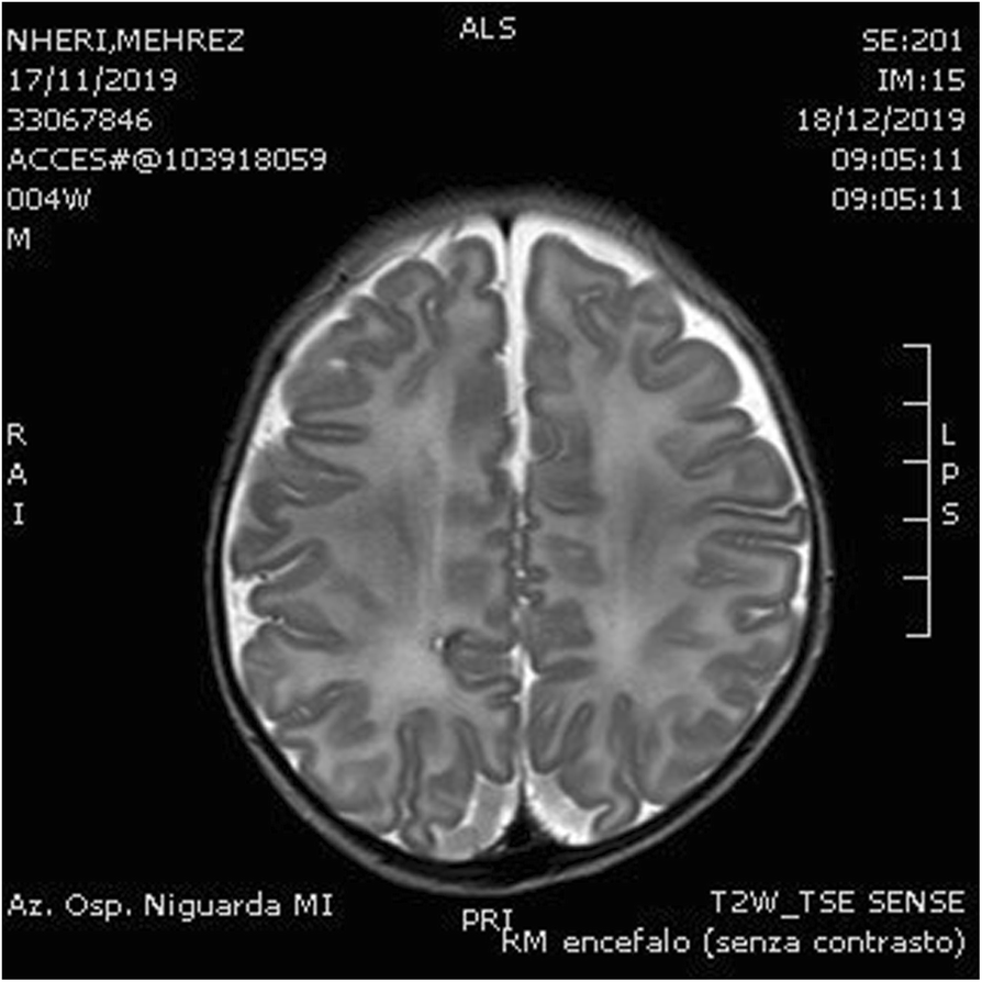 Fig.2 (abstract A19).