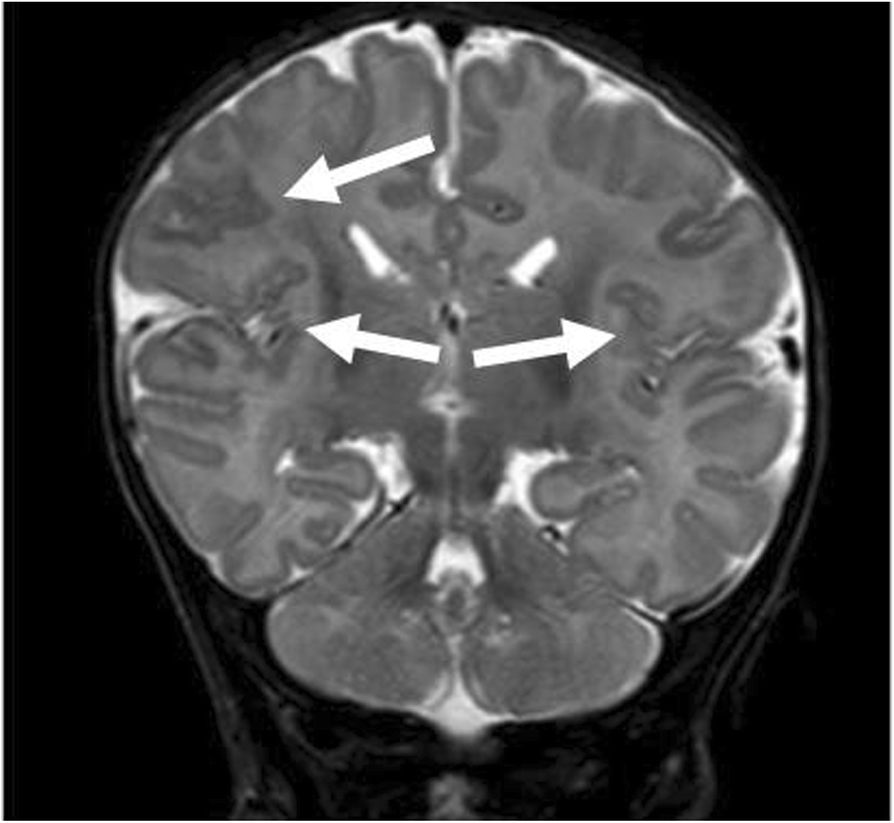 Fig. 2 (abstract A26).