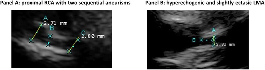 Fig. 1 (abstract A28).