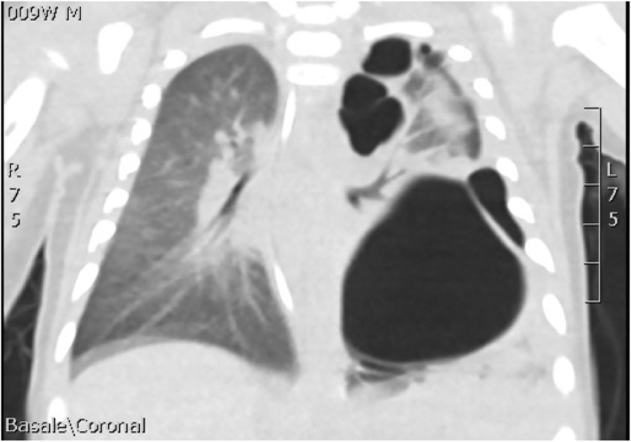 Fig. 4 (abstract A31).