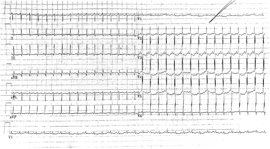 Fig. 1 (abstract A6).