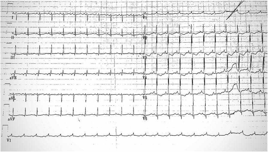 Fig. 2 (abstract A6).