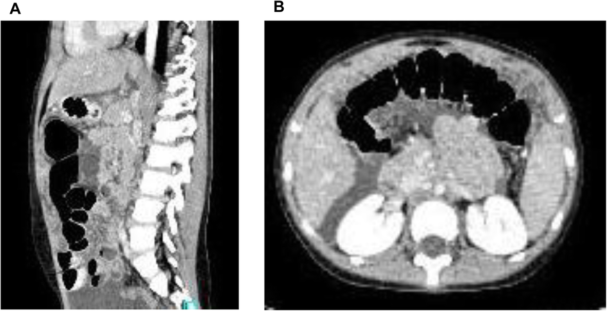 Fig. 1