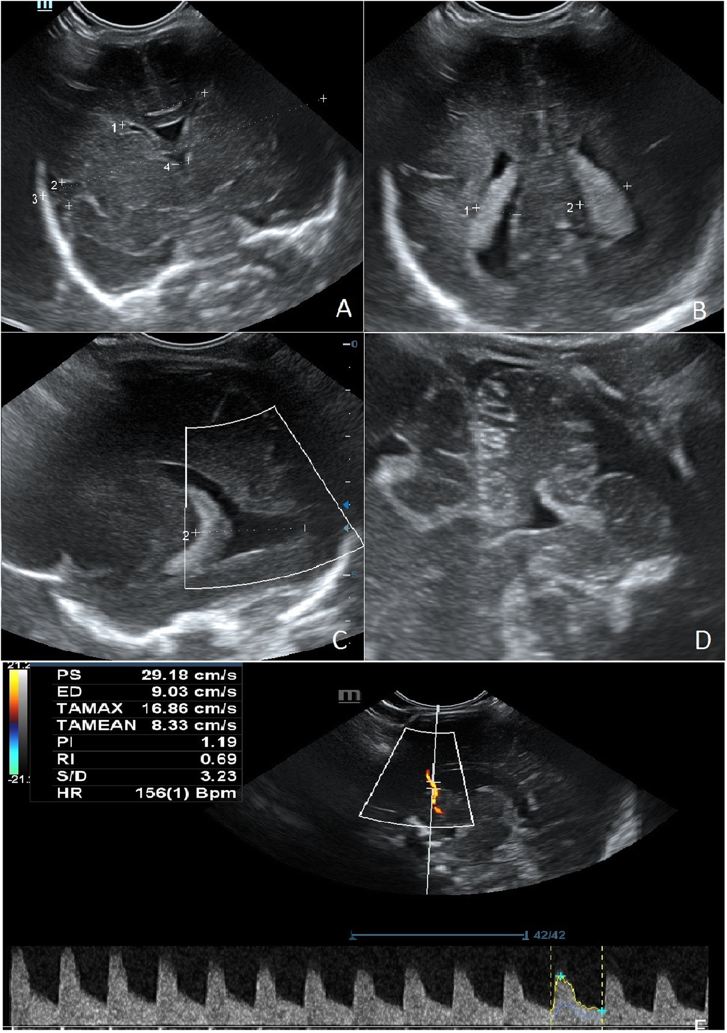 Fig. 5