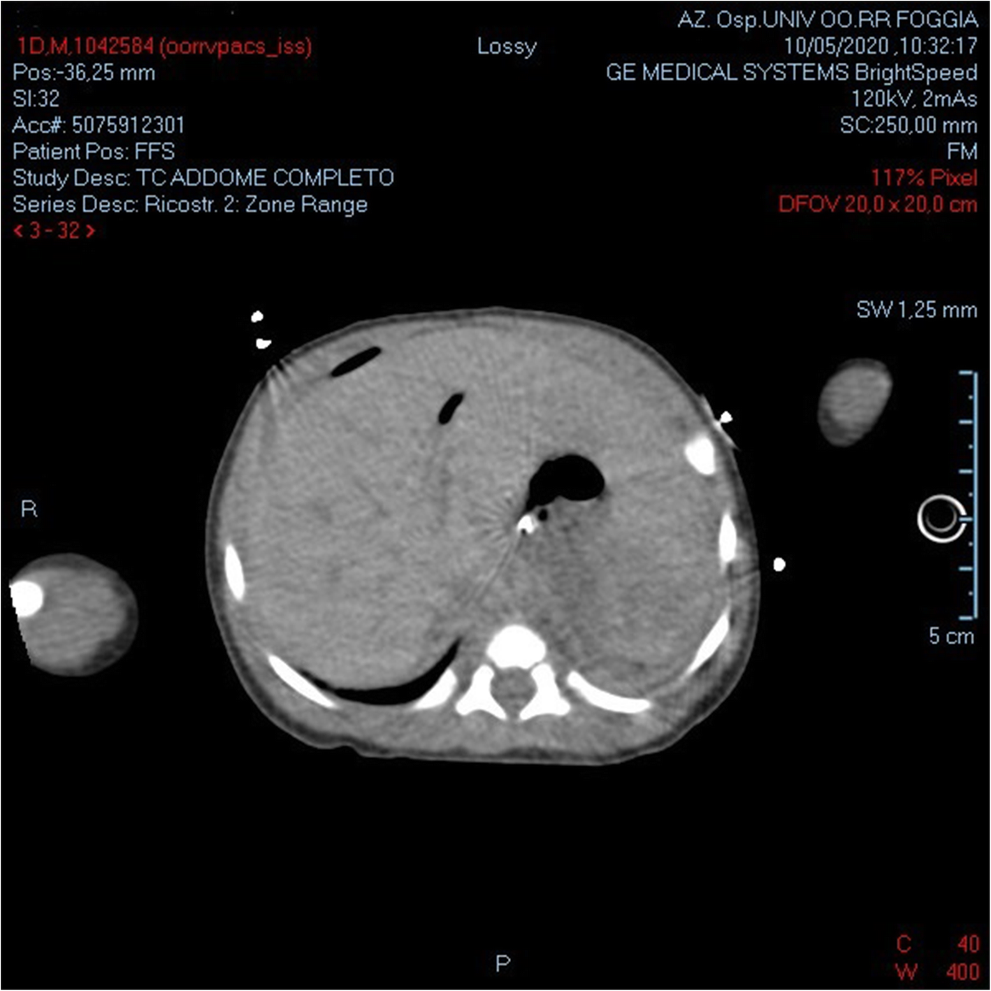 Fig. 3