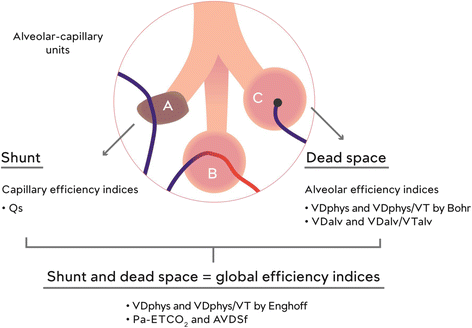 shunt vs dead space mneumonic shunt vs dead space mneumonic