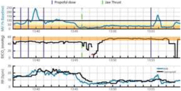 Fig. 1 (abstract P222).