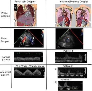 Fig. 1 (abstract P160).