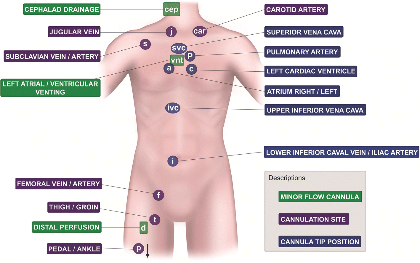 The ELSO Maastricht Treaty for ECLS Nomenclature: abbreviations for  cannulation configuration in extracorporeal life support - a position paper  of the Extracorporeal Life Support Organization | Critical Care | Full Text