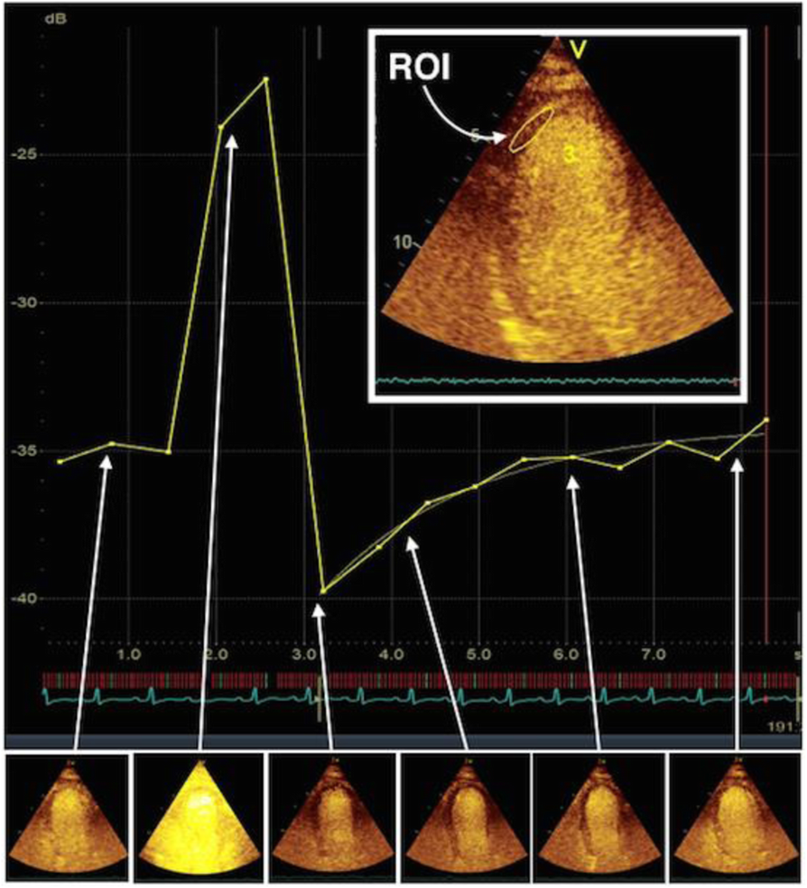 Fig. 1 (abstract P154).