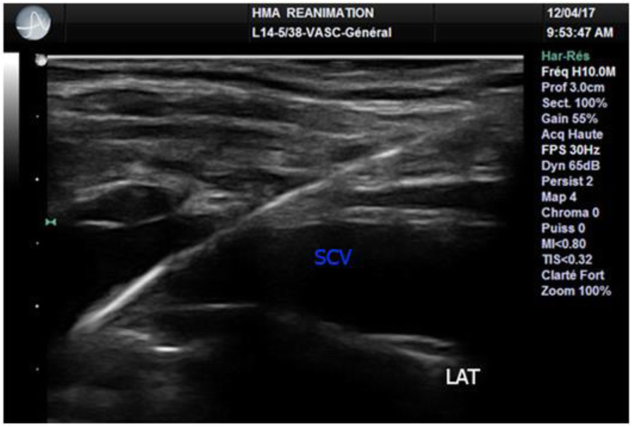 Fig. 2 (abstract P160).