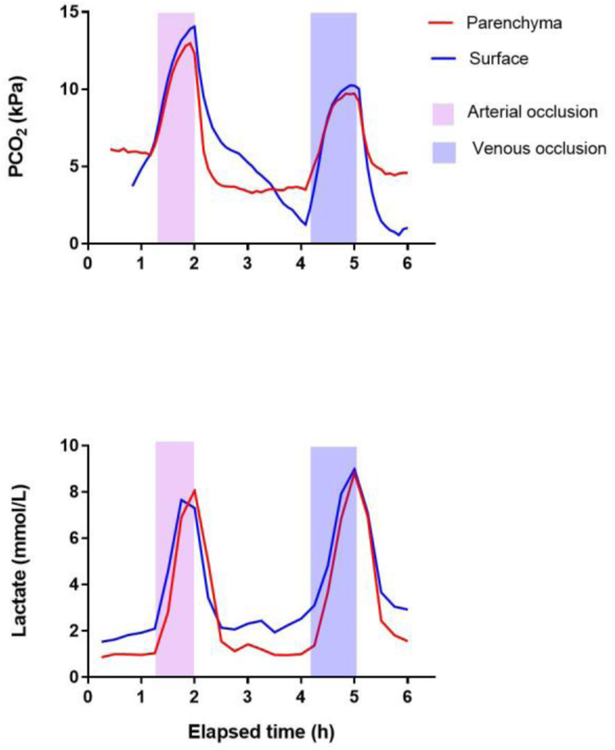 Fig. 1 (abstract P168).