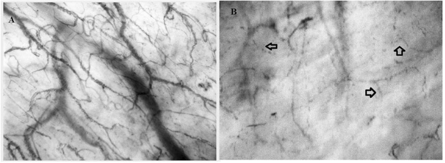 Fig. 1 (abstract P170).