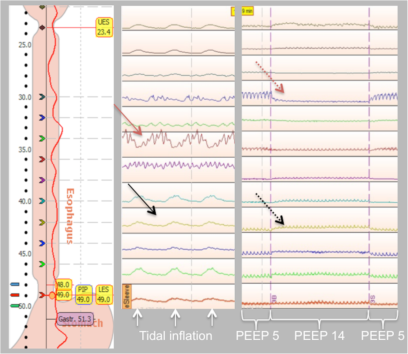 Fig. 2