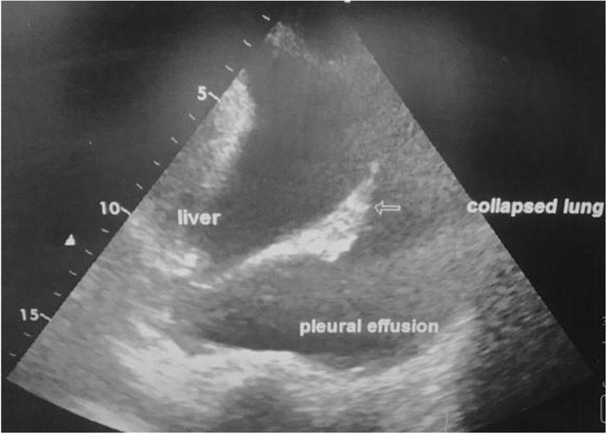 Fig. 1 (abstract P537).