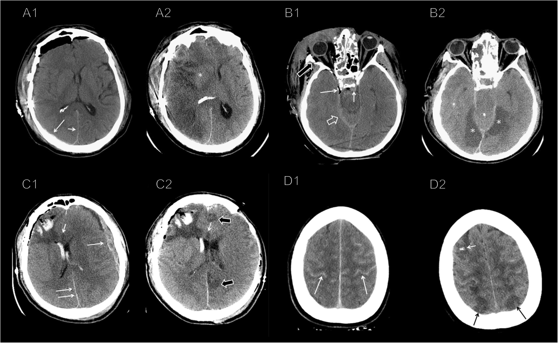 Fig. 2