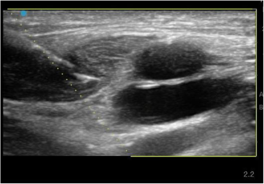 Fig. 1 (abstract P196).