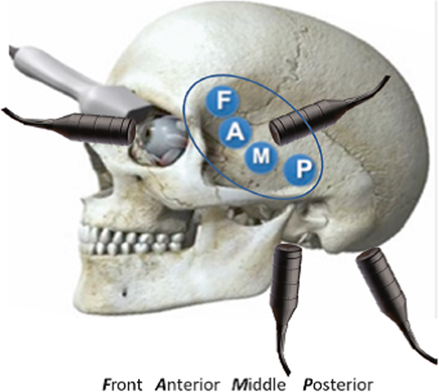 Fig. 3