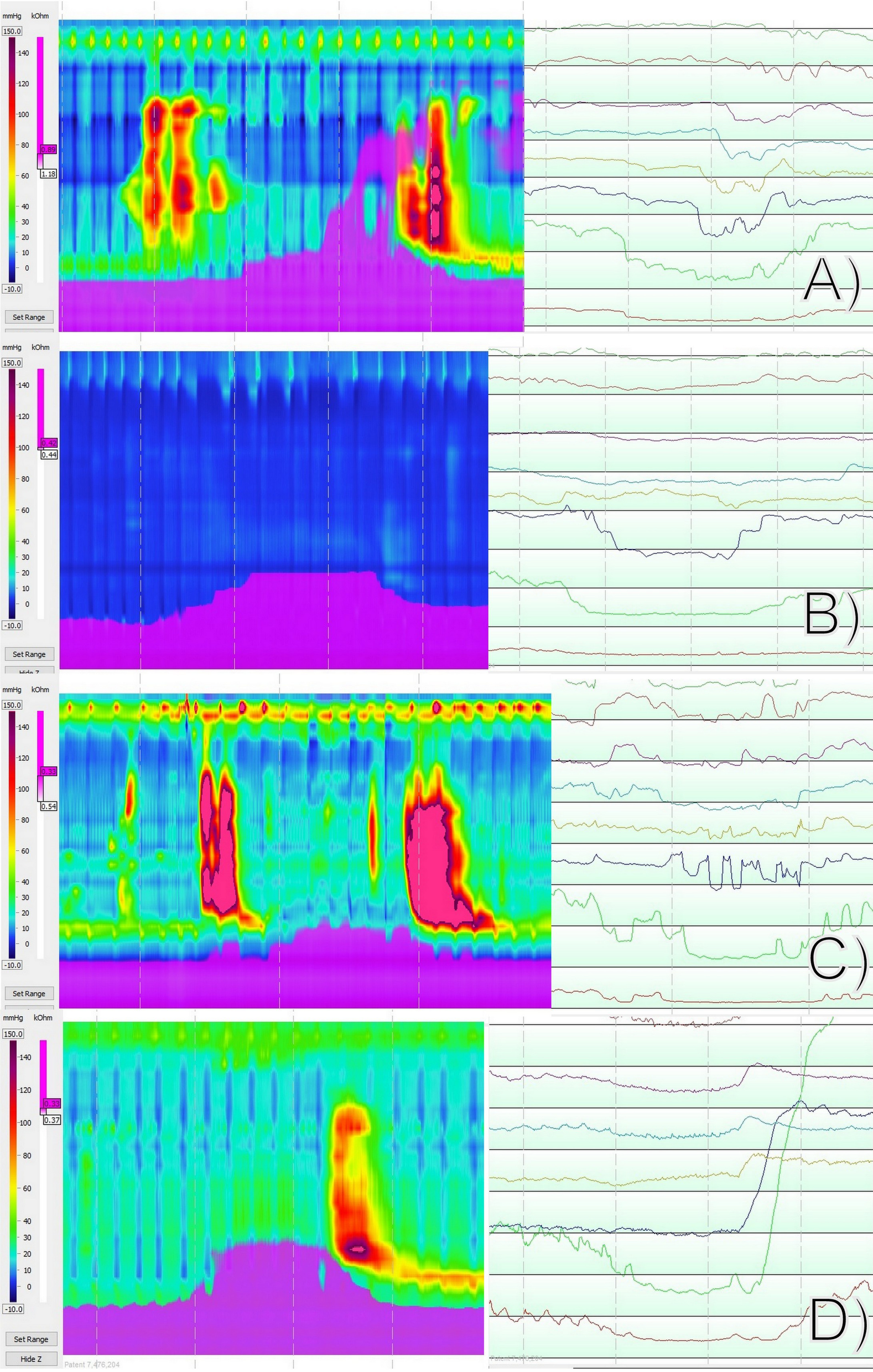 Fig. 3