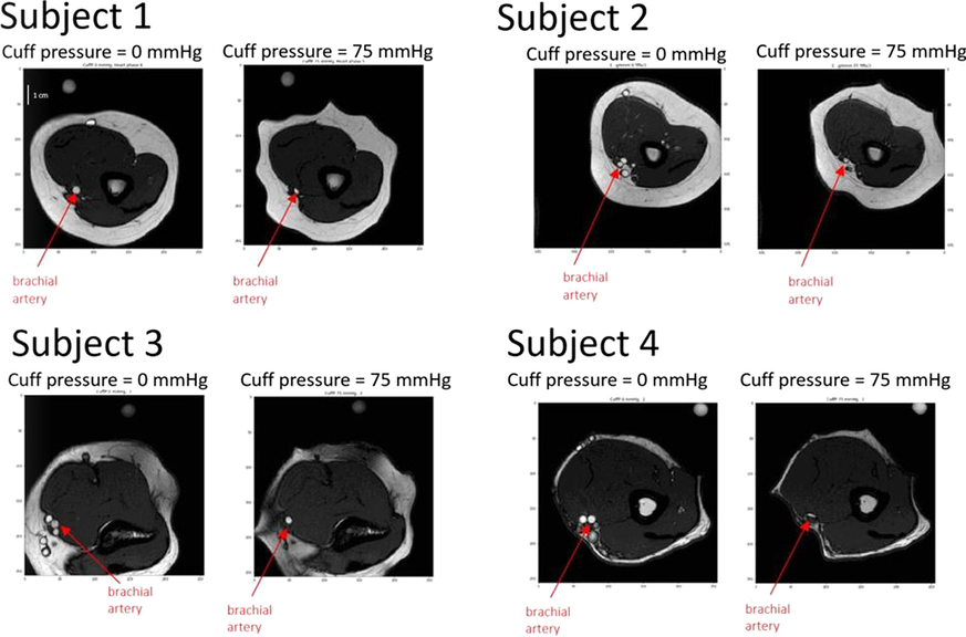 Fig. 1 (abstract P027)