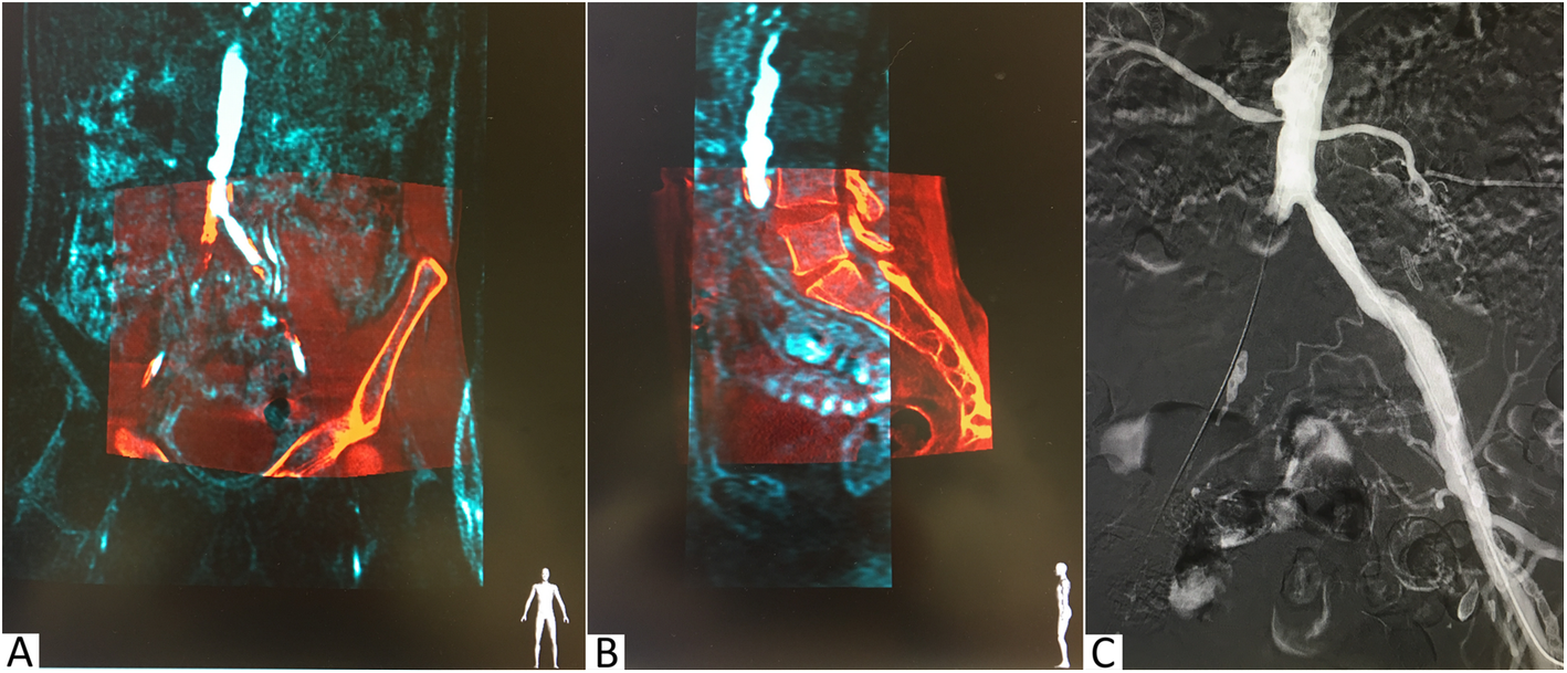 Fig. 1