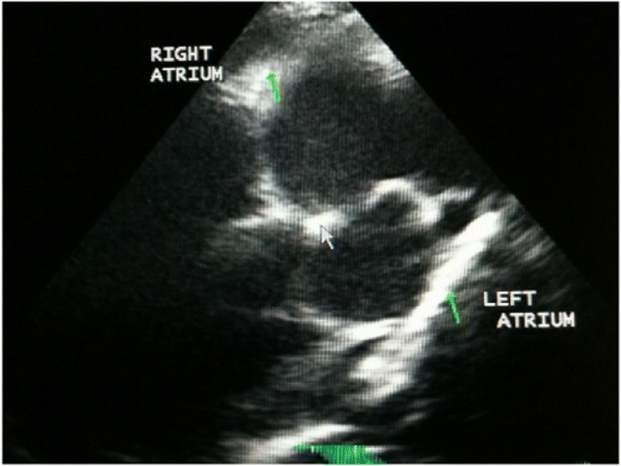 Fig. 2 (abstract O15).