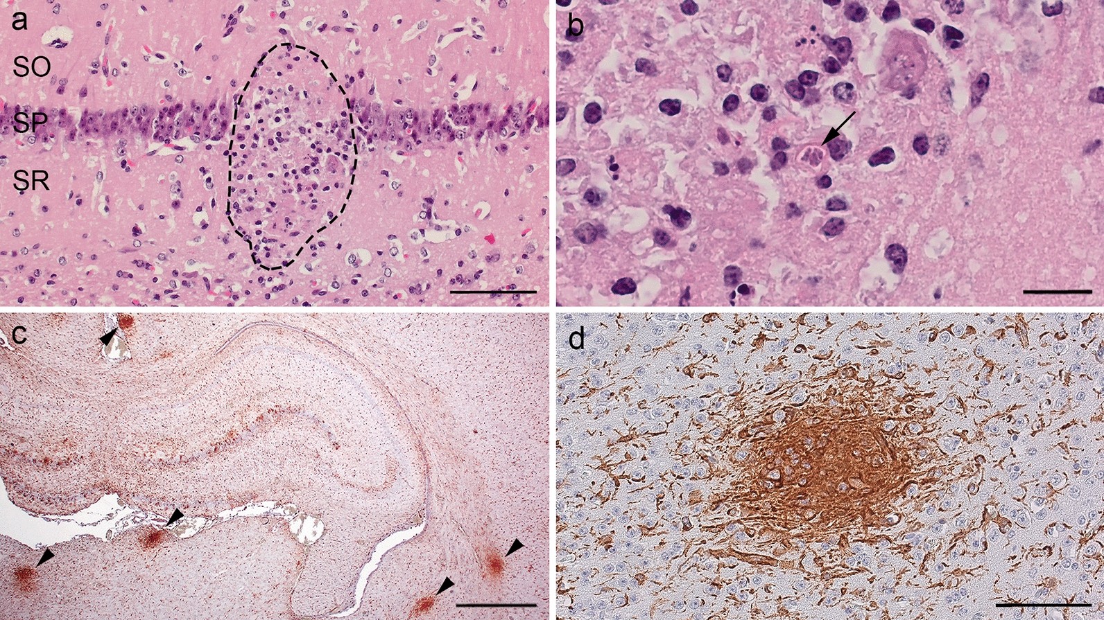 Fig. 10