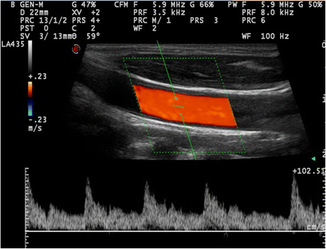 Fig. 2