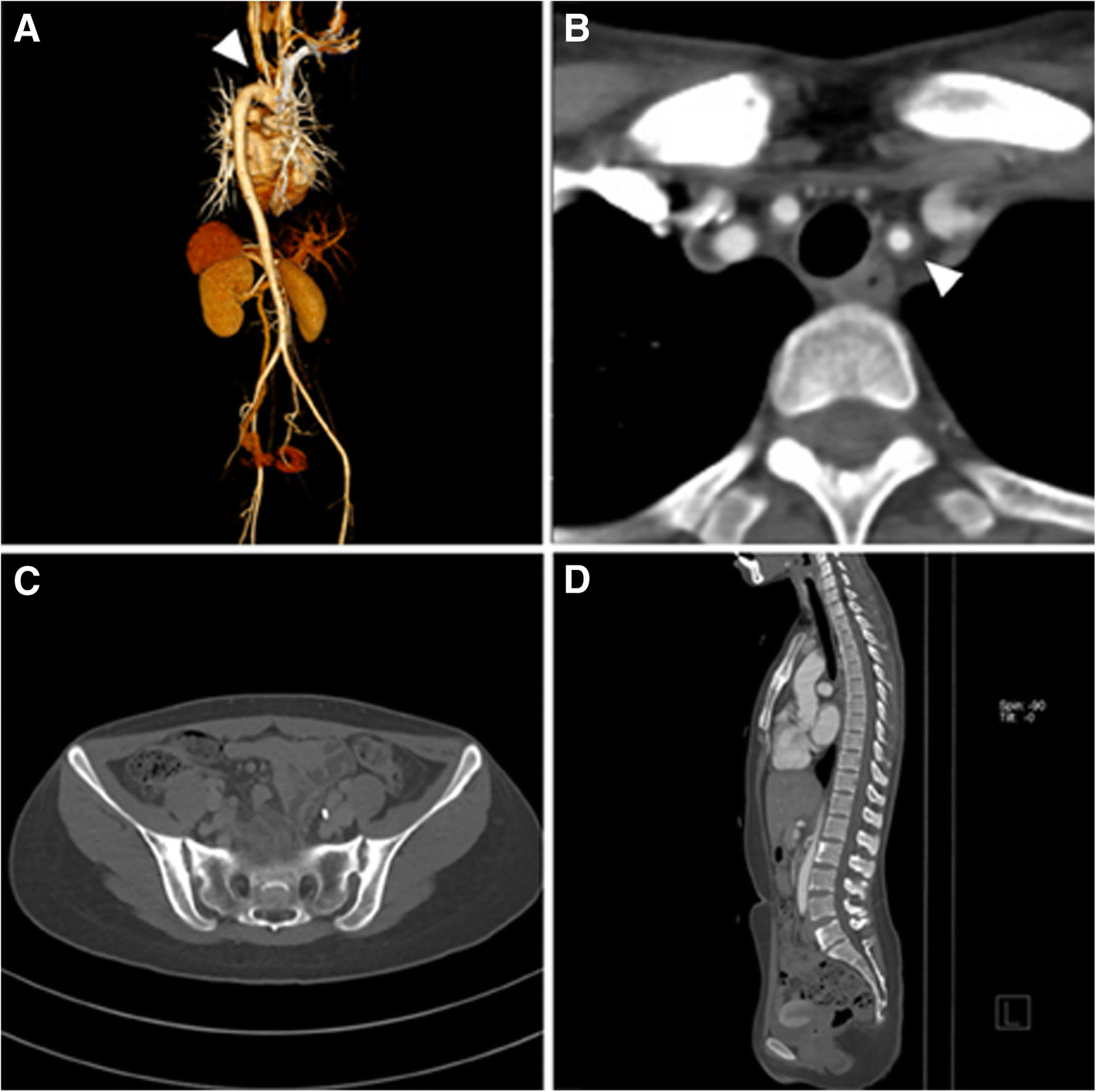 Fig. 1