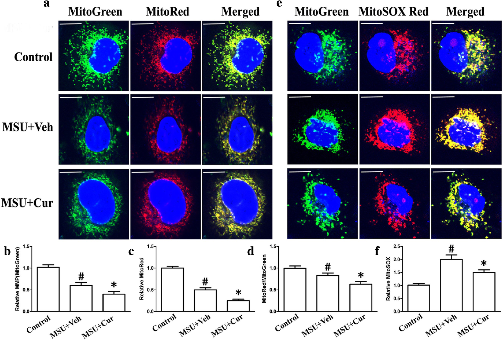 Curcumin crystal-induced inflammation by inhibiting the degradation of IκBα and blocking mitochondrial damage | Arthritis Research & | Full Text