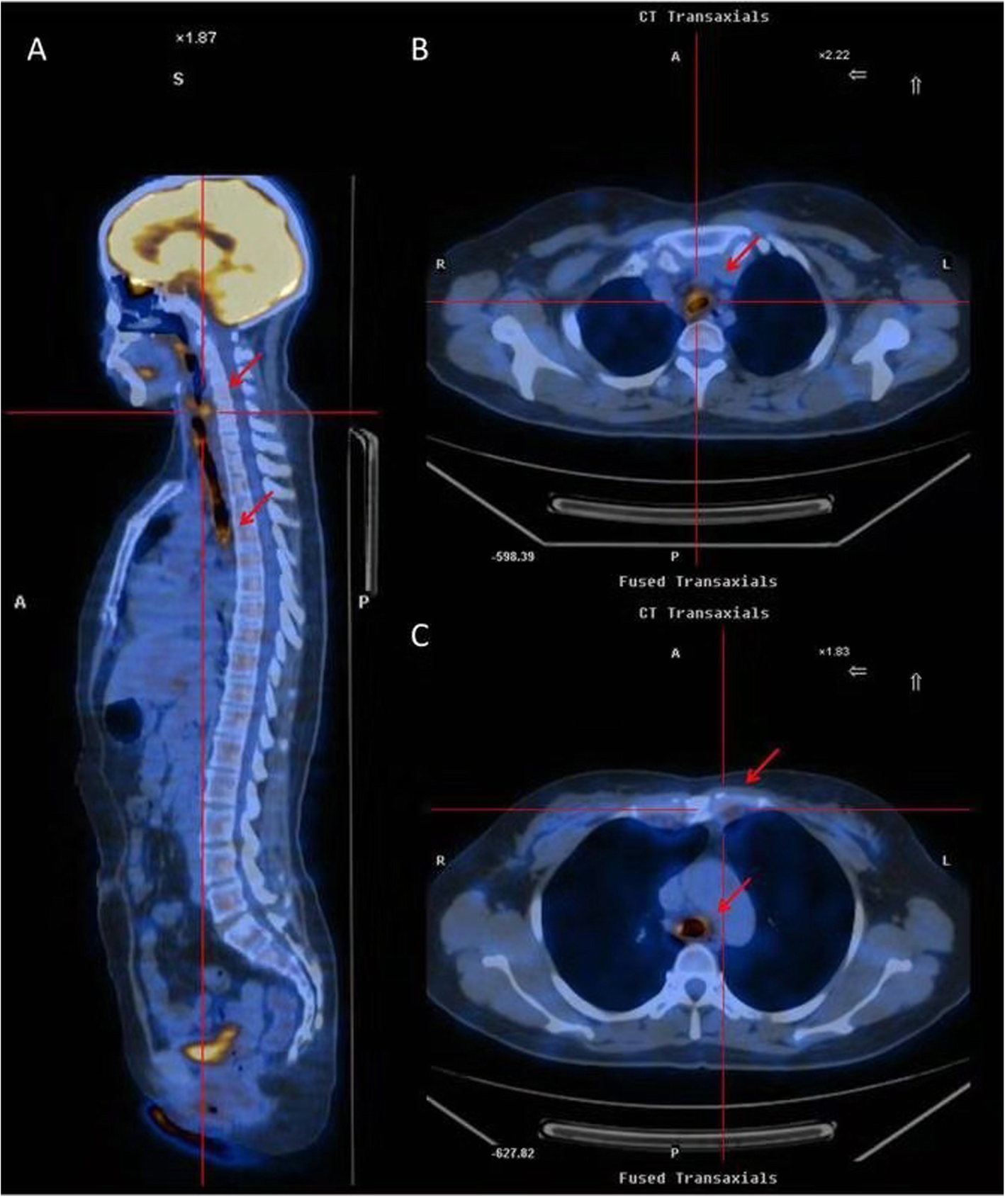 Fig. 2