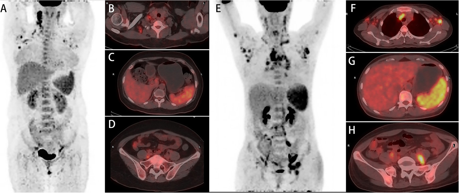 Fig. 1