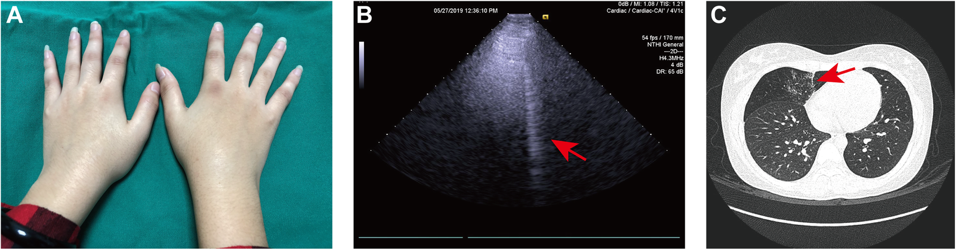 Fig. 3