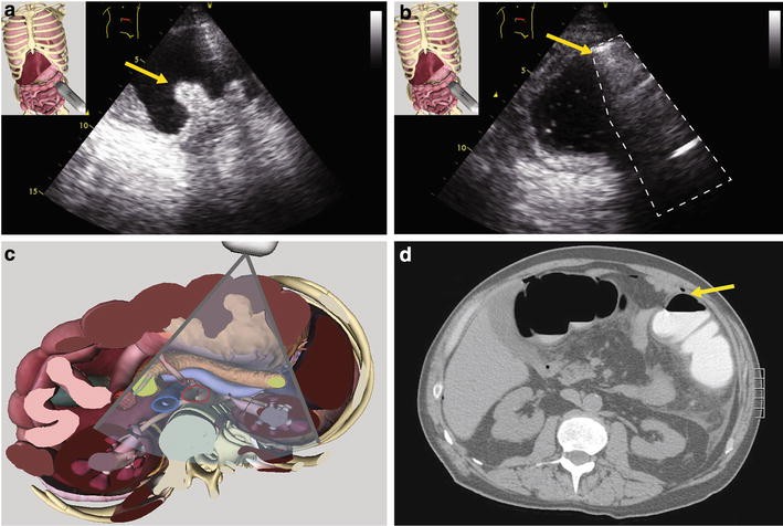 Fig. 2