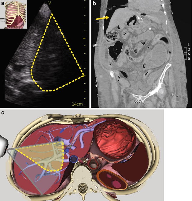 Fig. 4