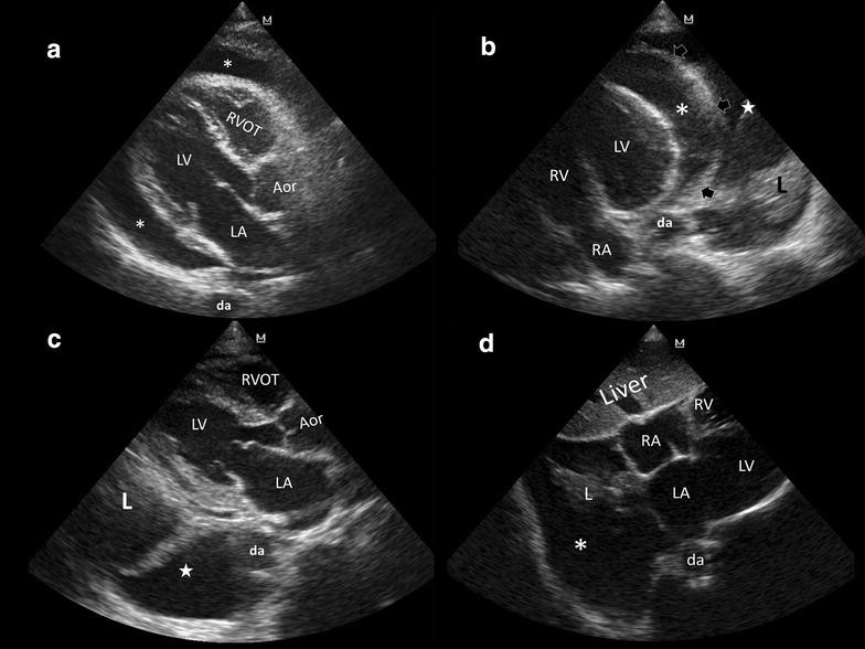 Fig. 1