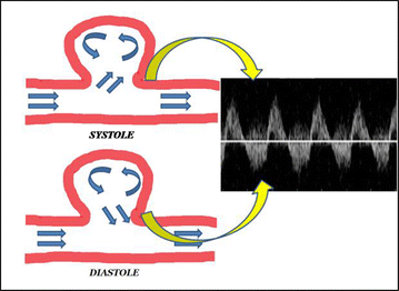 Fig. 14